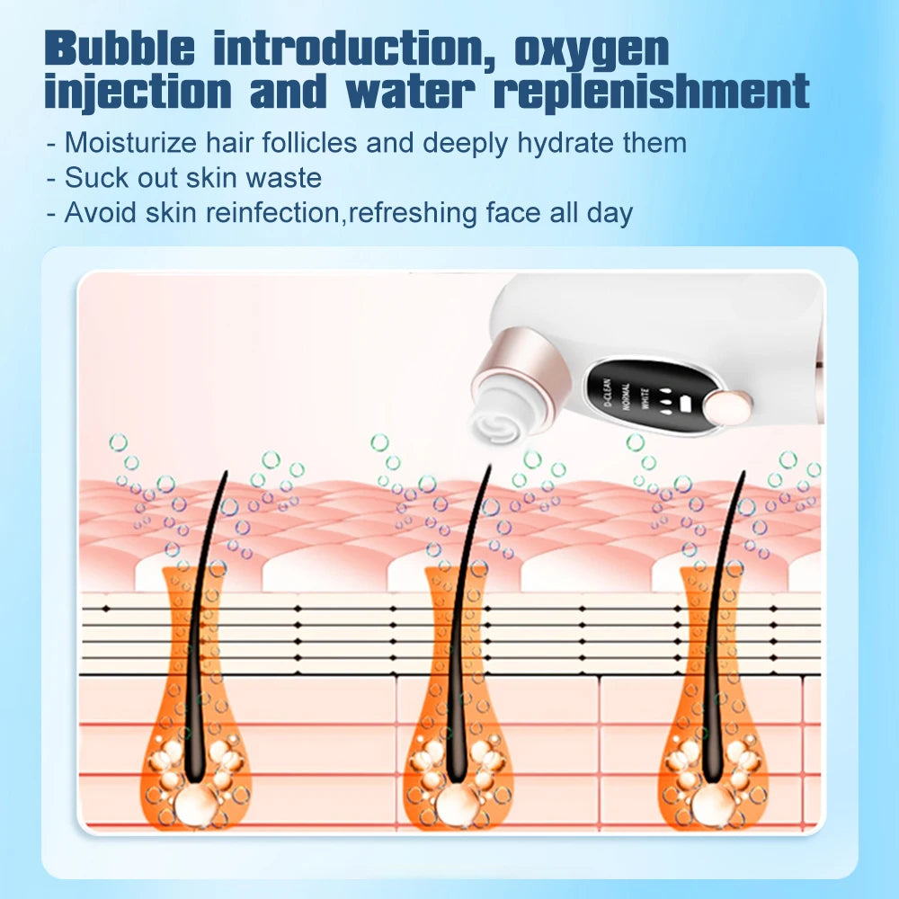 Electric Bubble Blackhead Remover Vacuum